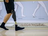 established orthotics prosthetics business