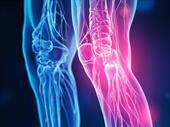 high-margin regenerative pain relief